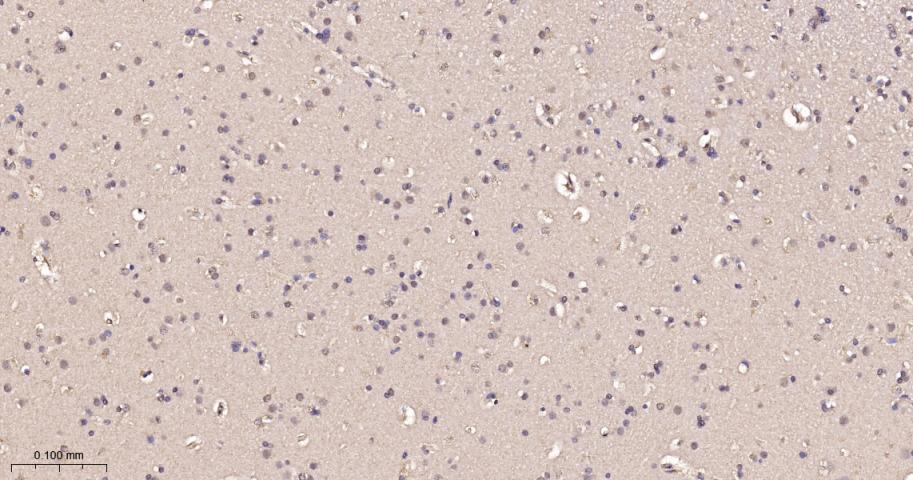p21激活激酶2重组兔单抗-bsm-61673R