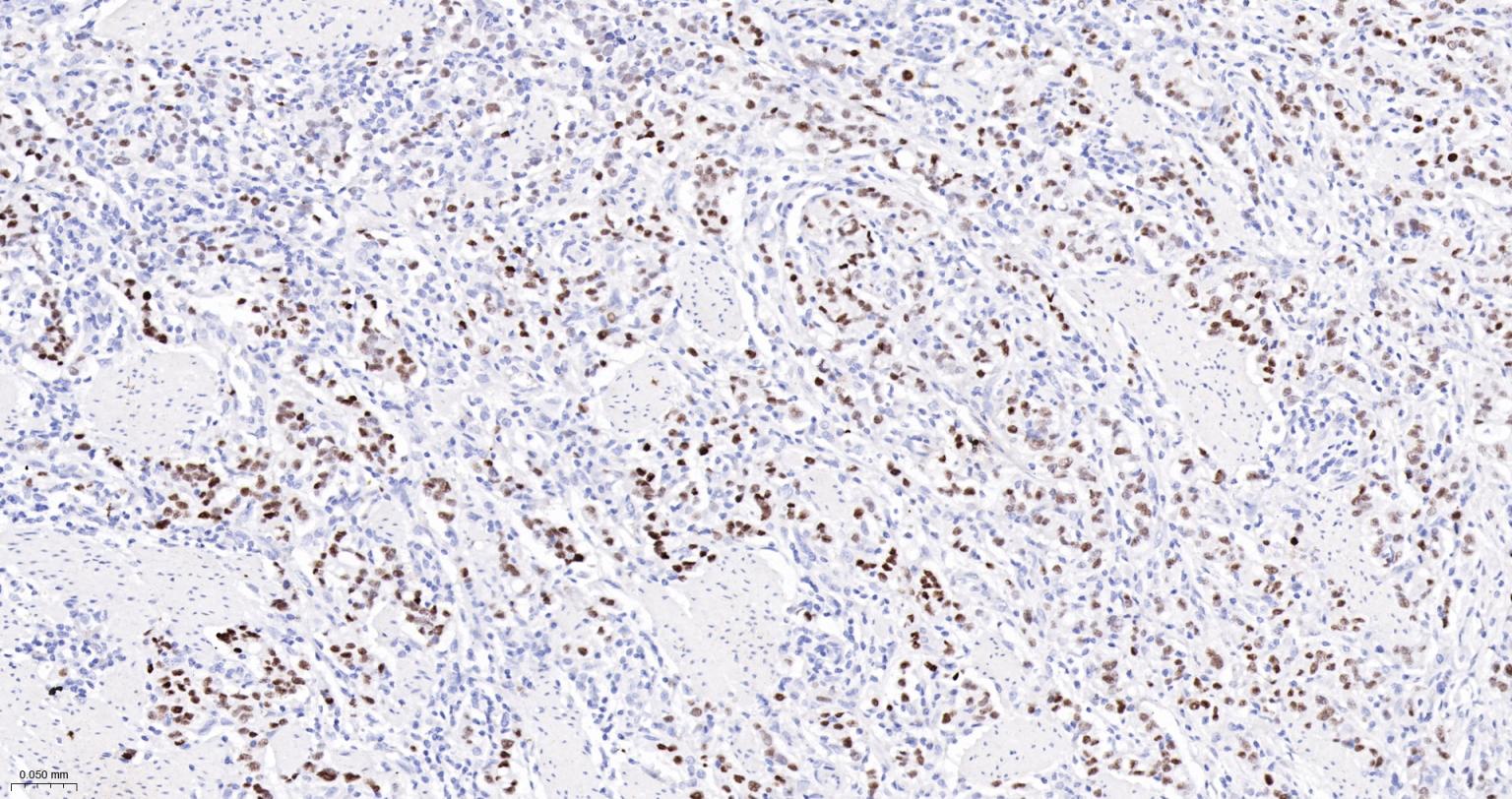 细胞肿瘤抗原P53重组兔单抗-bsm-60806R