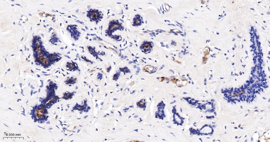 G蛋白偶联受体6重组兔单抗-bsm-62179R