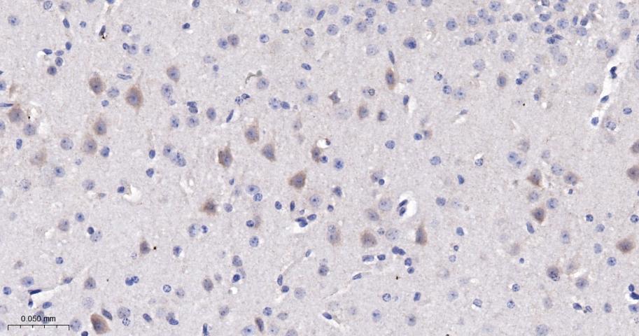 鞘氨醇激酶2抗体-bs-2653R