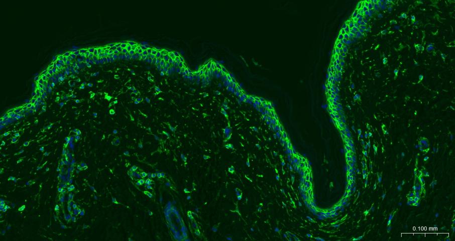 CD44重组兔单抗-bsm-54767R