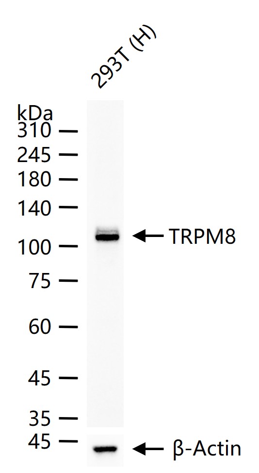 “冷”蛋白TRPM8重组兔单抗-bsm-61651R