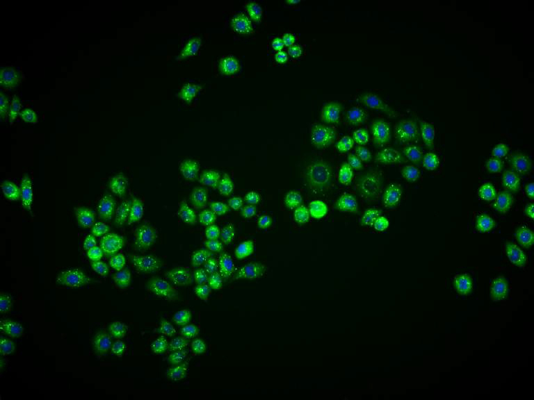 泛素结合蛋白P62重组兔单抗-bsm-60709R