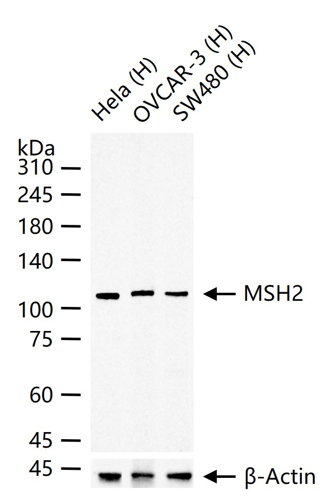 错配修复蛋白2重组兔单抗-bsm-60222R