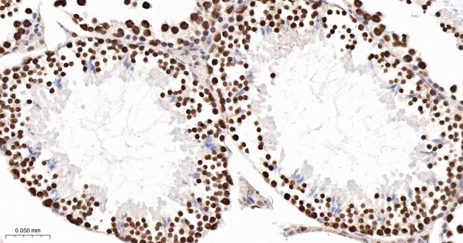 转录中介因子Tif1β重组兔单抗-bsm-63000R