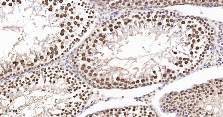 转录中介因子Tif1β重组兔单抗-bsm-63000R