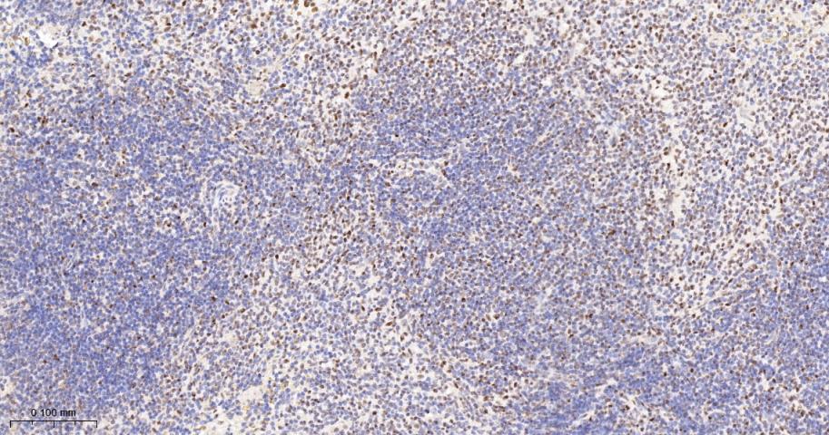 转录中介因子Tif1β重组兔单抗-bsm-63000R