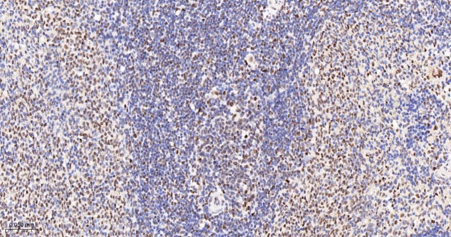 转录中介因子Tif1β重组兔单抗-bsm-63000R