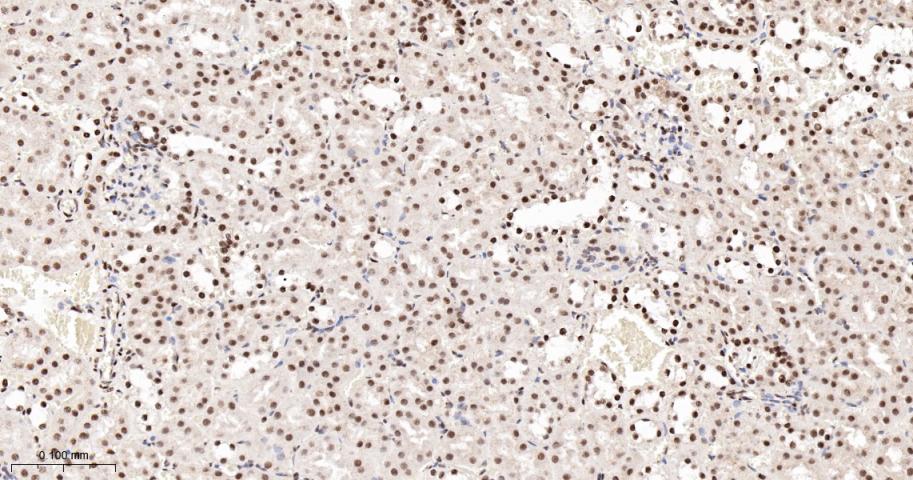 转录中介因子Tif1β重组兔单抗-bsm-63000R