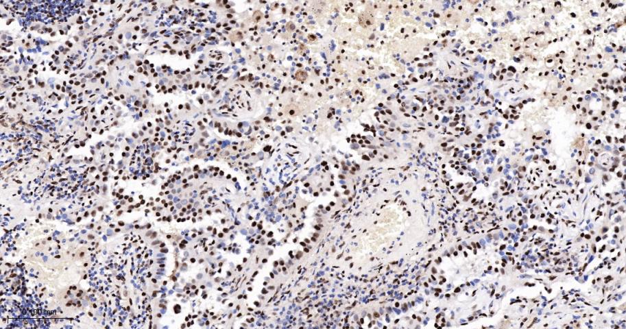 转录中介因子Tif1β重组兔单抗-bsm-63000R