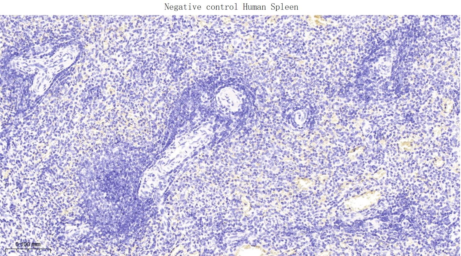 突触相关蛋白25重组兔单抗-bsm-62983R