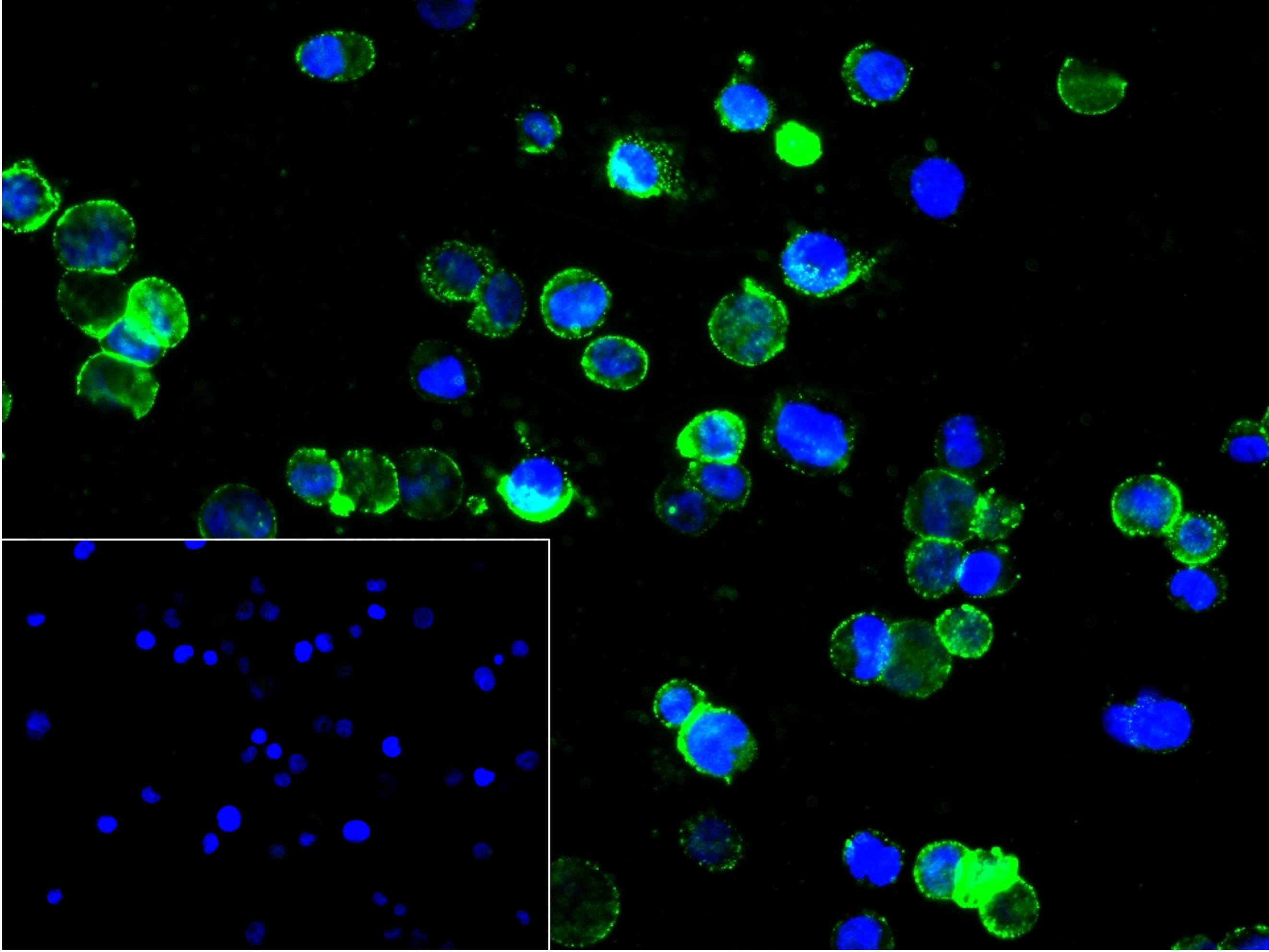 CD81重组兔单抗-bsm-52640R