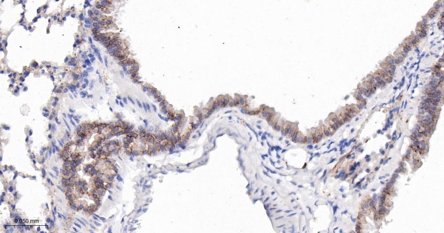 活化白细胞粘附分子重组兔单抗-bsm-61678R