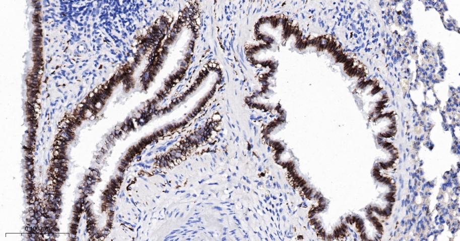 活化白细胞粘附分子重组兔单抗-bsm-61678R