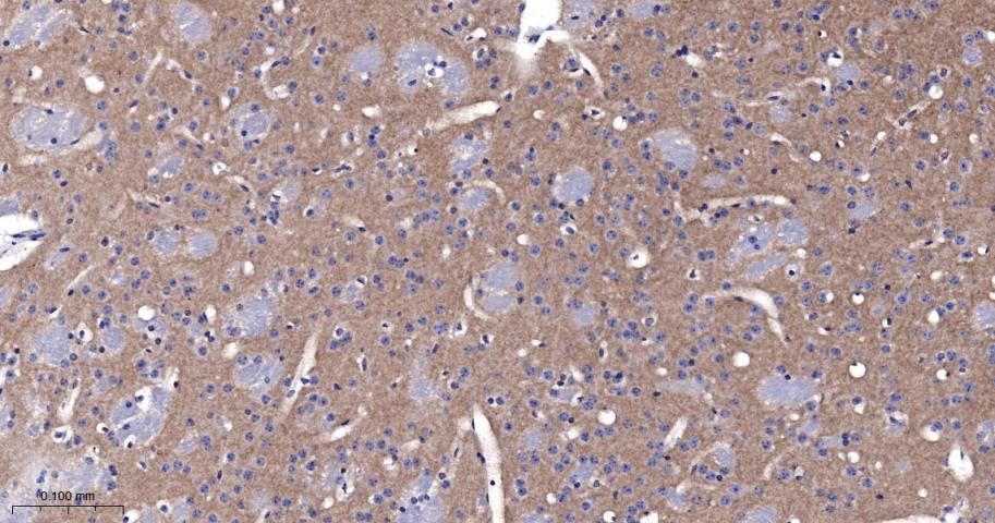 活化白细胞粘附分子重组兔单抗-bsm-61678R