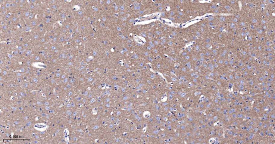 活化白细胞粘附分子重组兔单抗-bsm-61678R