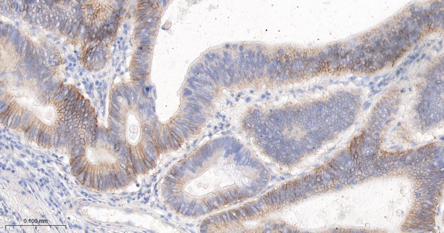 活化白细胞粘附分子重组兔单抗-bsm-61678R