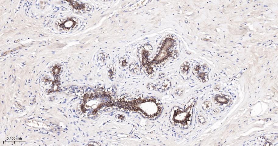 活化白细胞粘附分子重组兔单抗-bsm-61678R