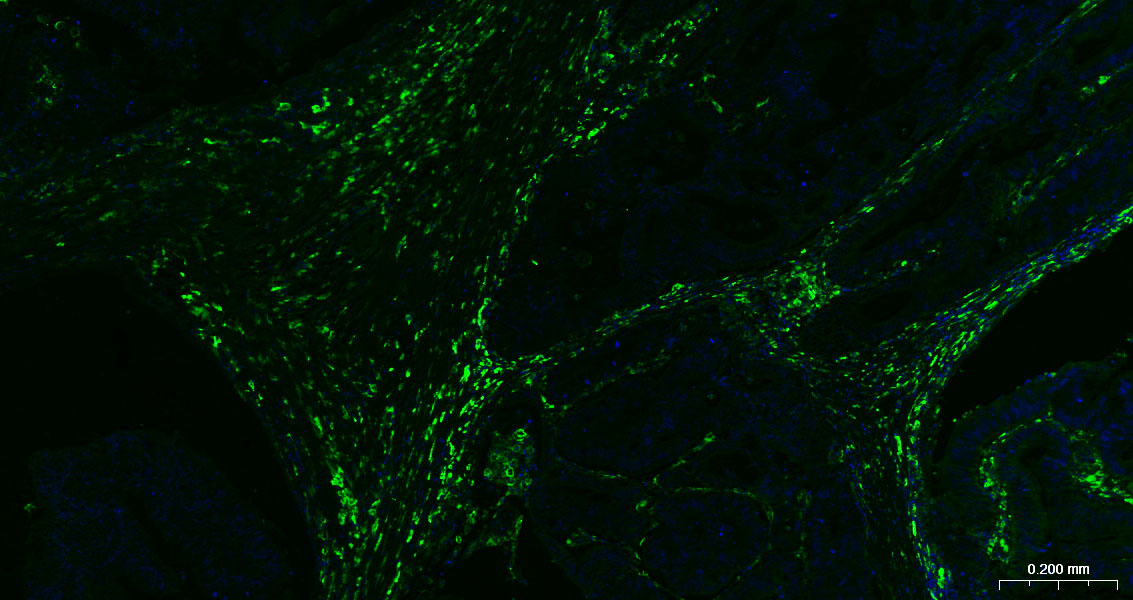 CD163重组兔单抗-bsm-54015R