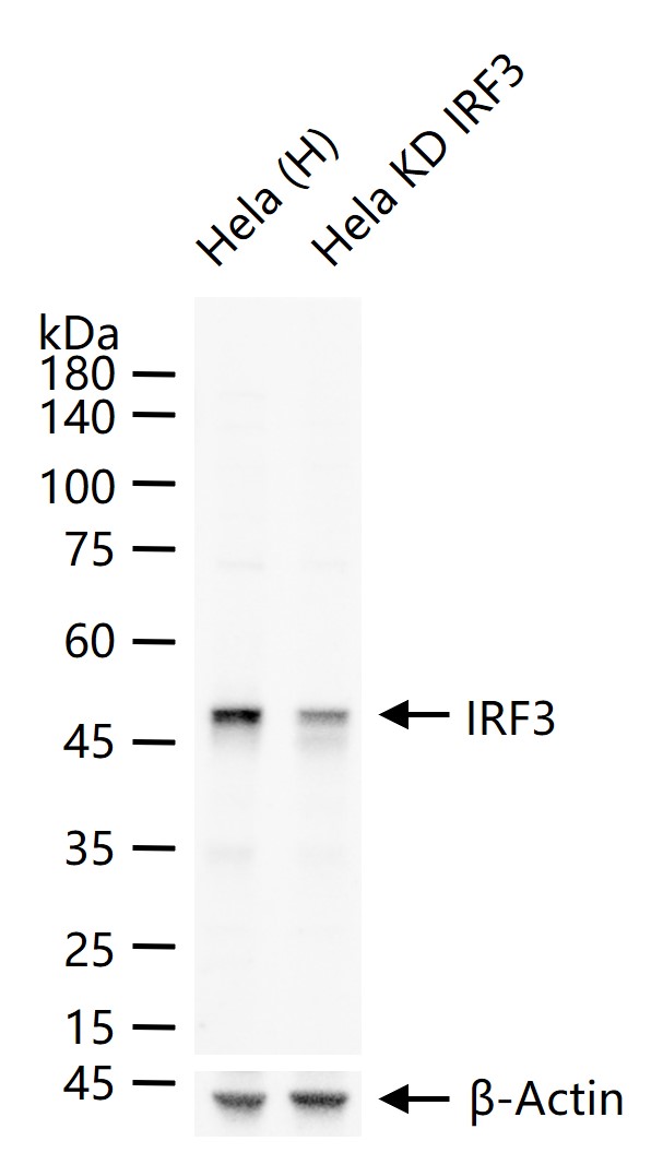 干扰素调节因子3重组兔单抗-bsm-52116R