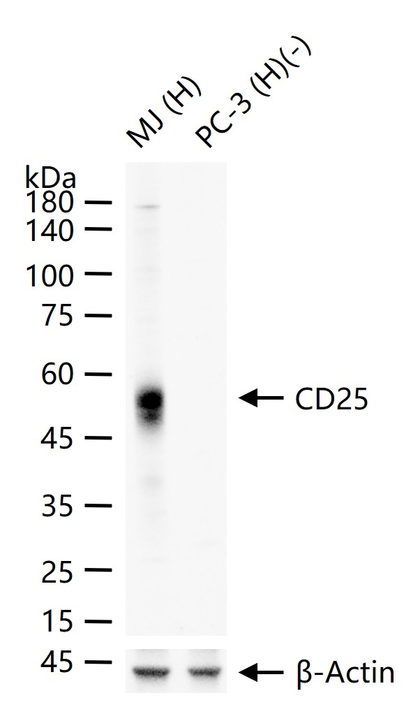 白介素2受体a链/ICD25重组兔单抗-bsm-60613R