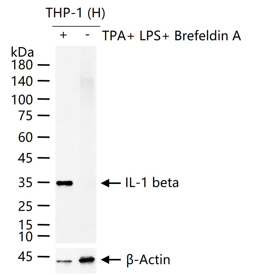 白介素1β/IL-1β抗体-bs-42553R