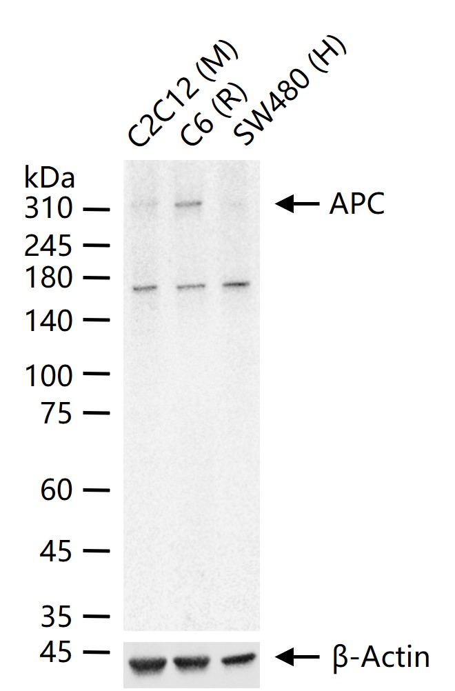 腺瘤样息肉重组兔单抗-bsm-61249R