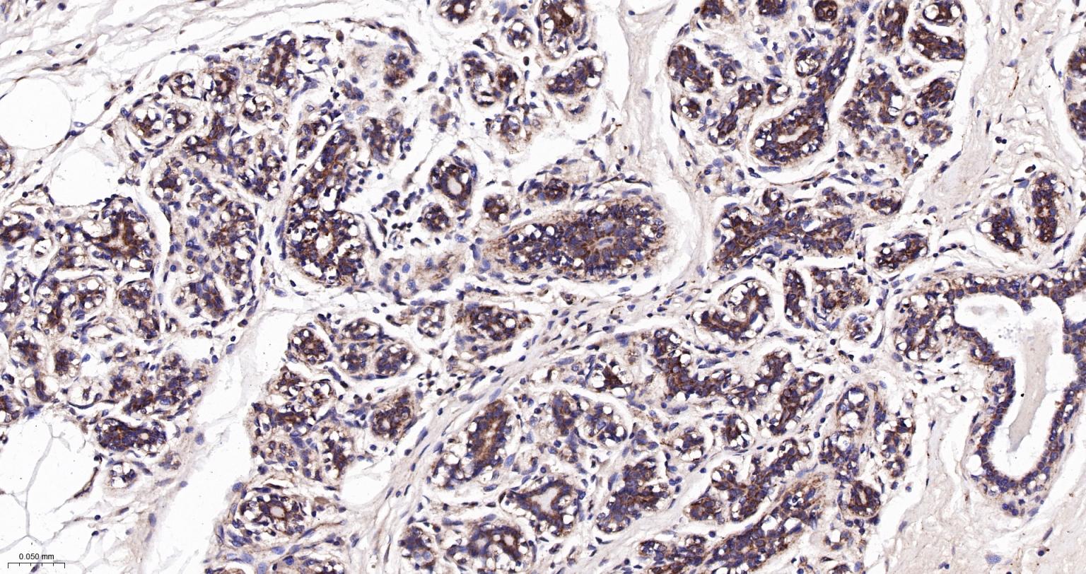 己糖激酶1重组兔单抗-bsm-61212R