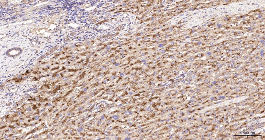 溶酶体相关膜蛋白1（CD107）重组兔单抗-bsm-41335R