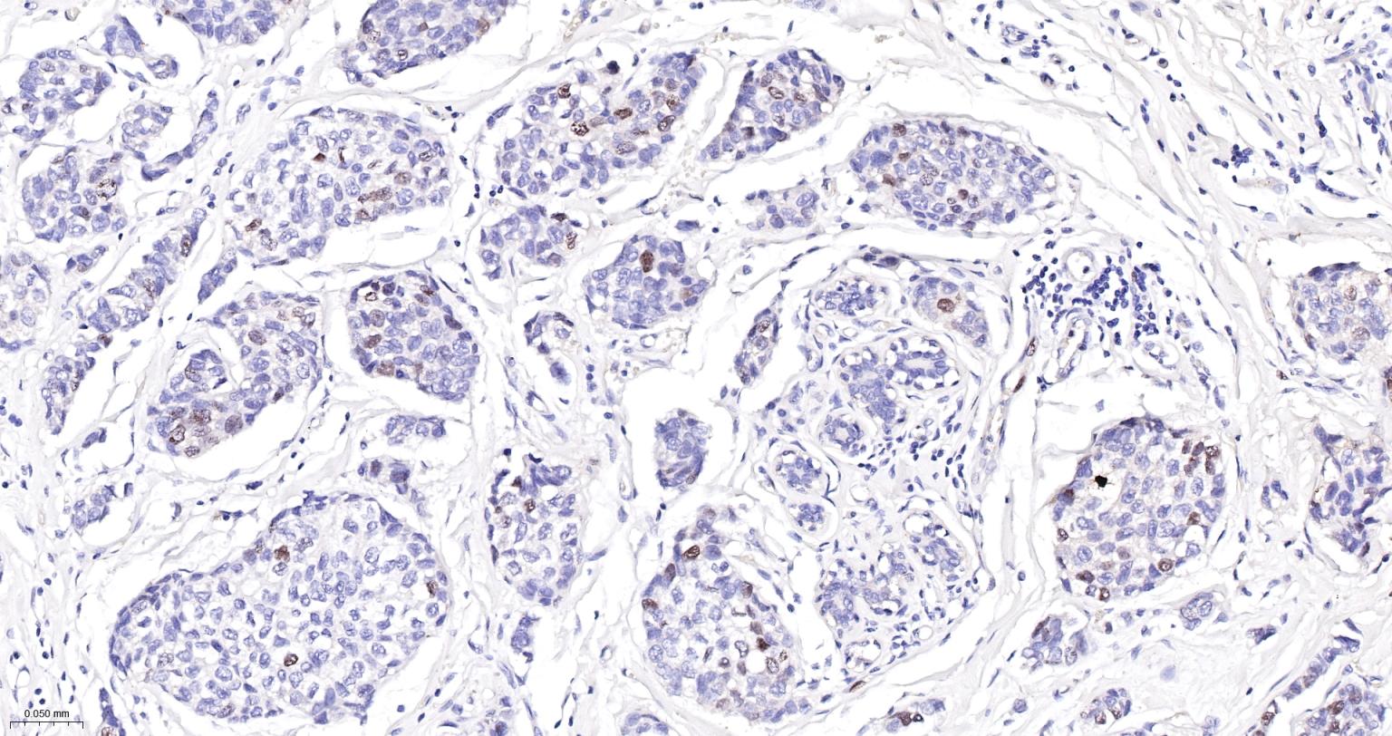 Ki67重组兔单抗-bsm-52455R