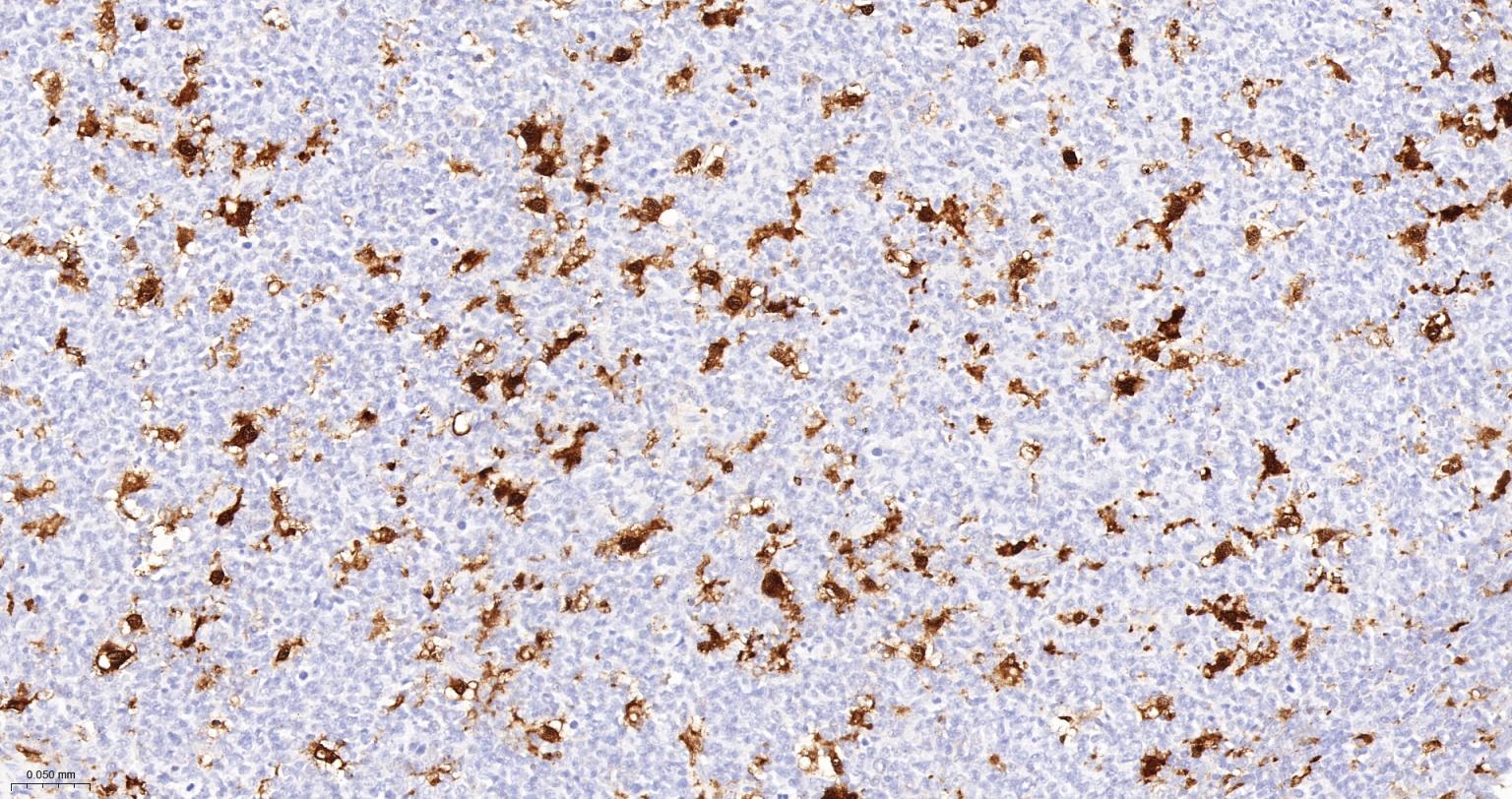 白细胞介素-18/干扰素γ诱导因子重组兔单抗-bsm-56205R
