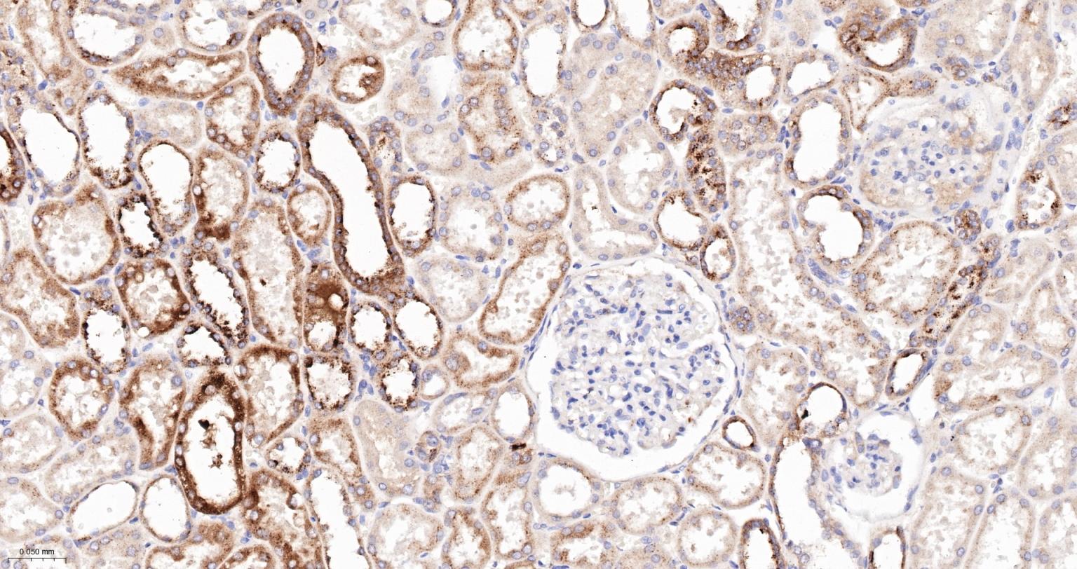 α-半乳糖苷酶重组兔单抗-bsm-62171R