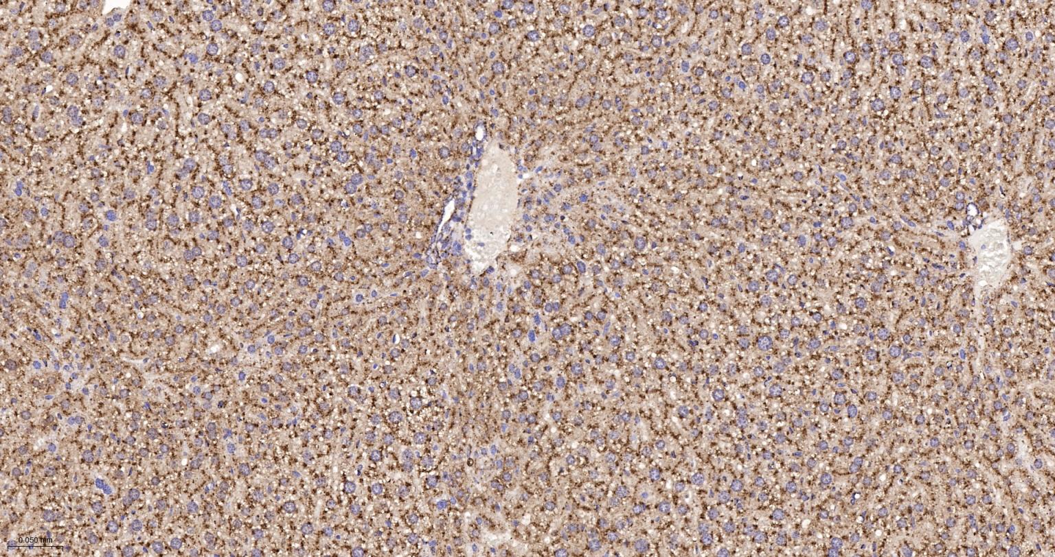 清道夫受体B2重组兔单抗-bsm-62192R