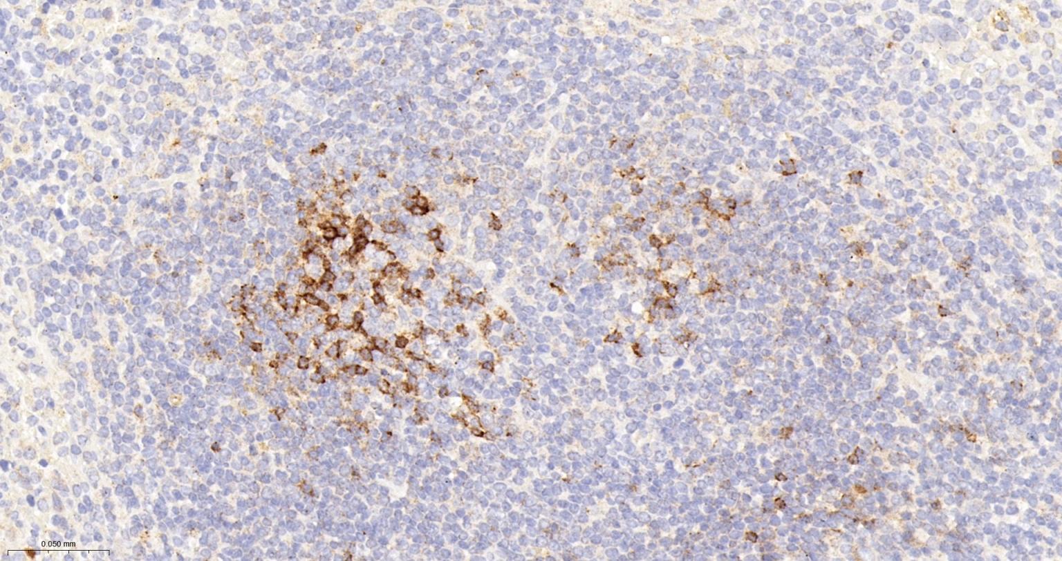 程序性死亡1（CD279）重组兔单抗-bsm-52367R