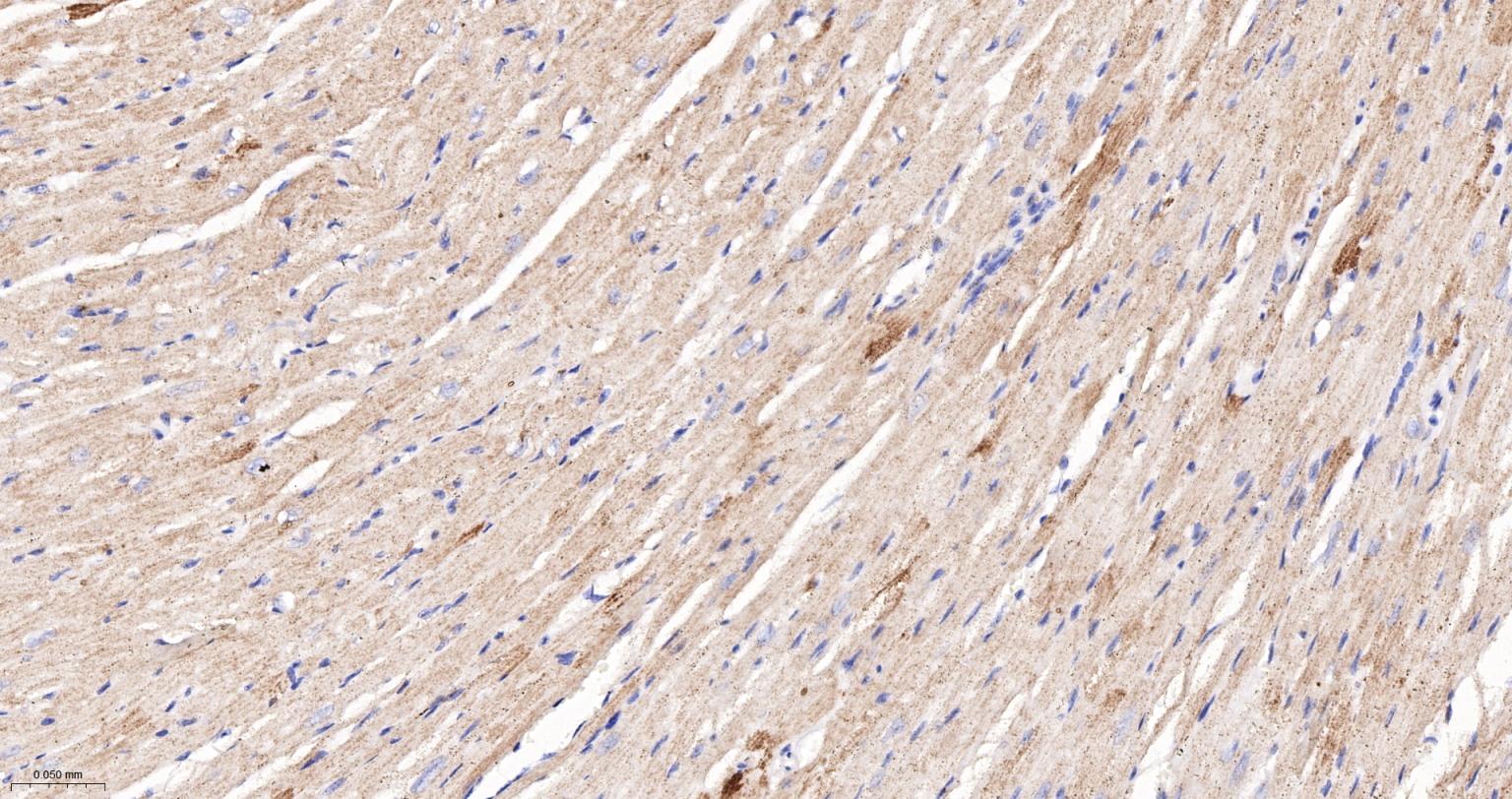丙酮酸脱氢酶E1β亚单位重组兔单抗-bsm-61702R