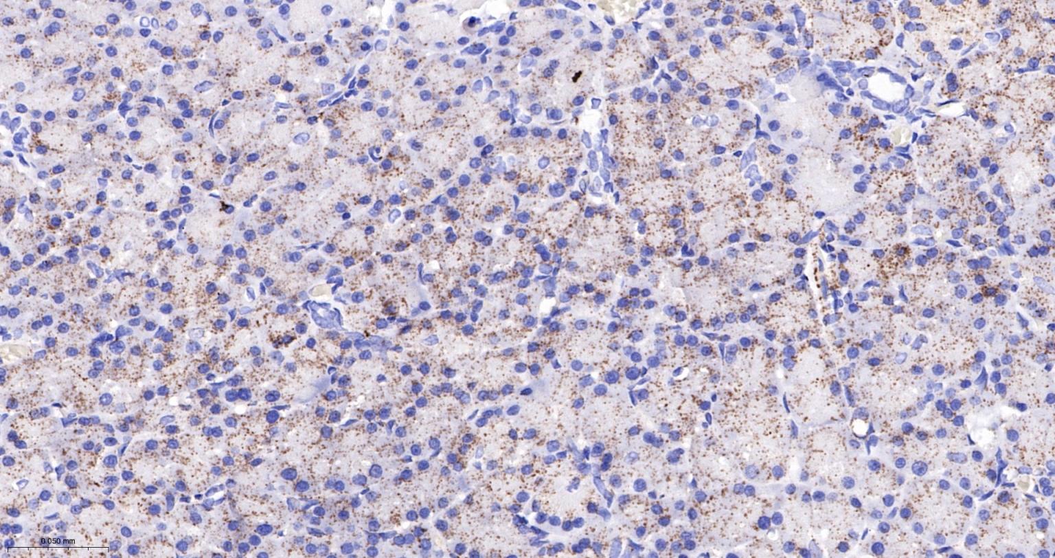 丙酮酸脱氢酶E1β亚单位重组兔单抗-bsm-61702R