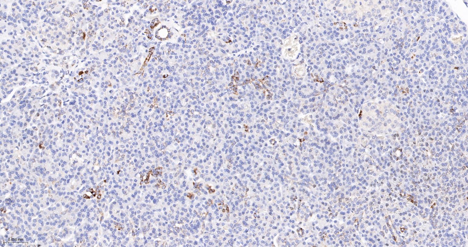 丙酮酸脱氢酶E1β亚单位重组兔单抗-bsm-61702R