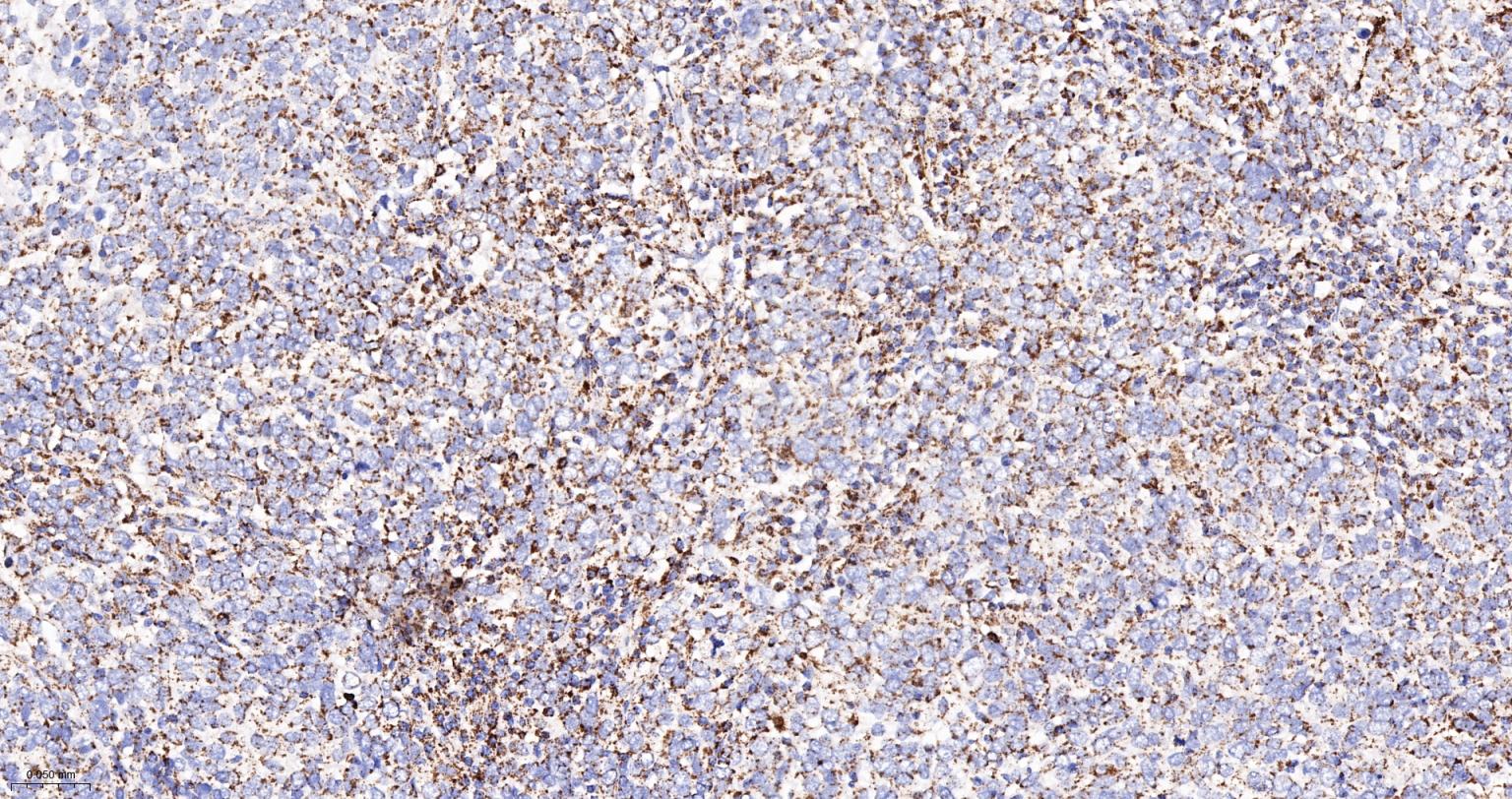 丙酮酸脱氢酶E1β亚单位重组兔单抗-bsm-61702R