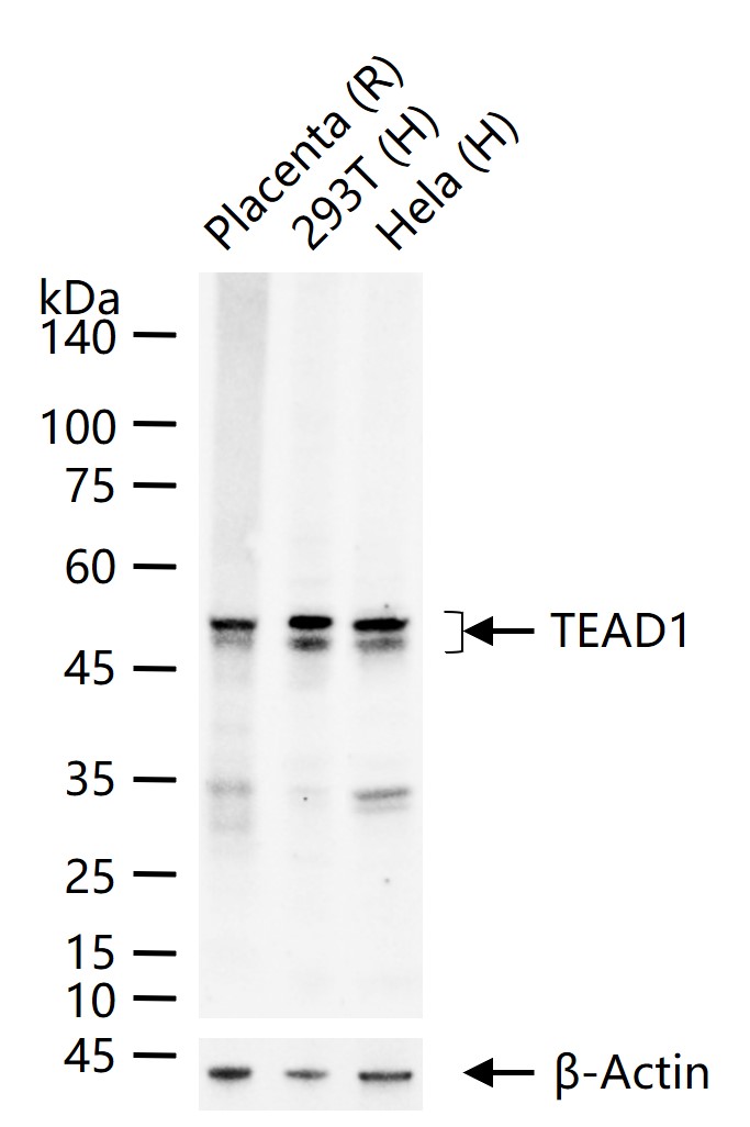 TEAD1重组兔单抗-bsm-63274R