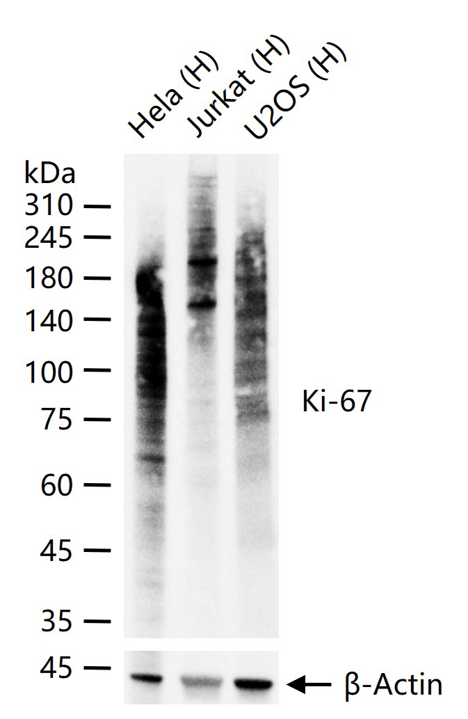 Ki67重组兔单抗-bsm-52455R