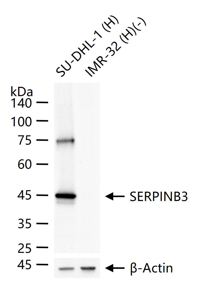 丝氨酸蛋白酶抑制剂B3重组兔单抗-bsm-43190R
