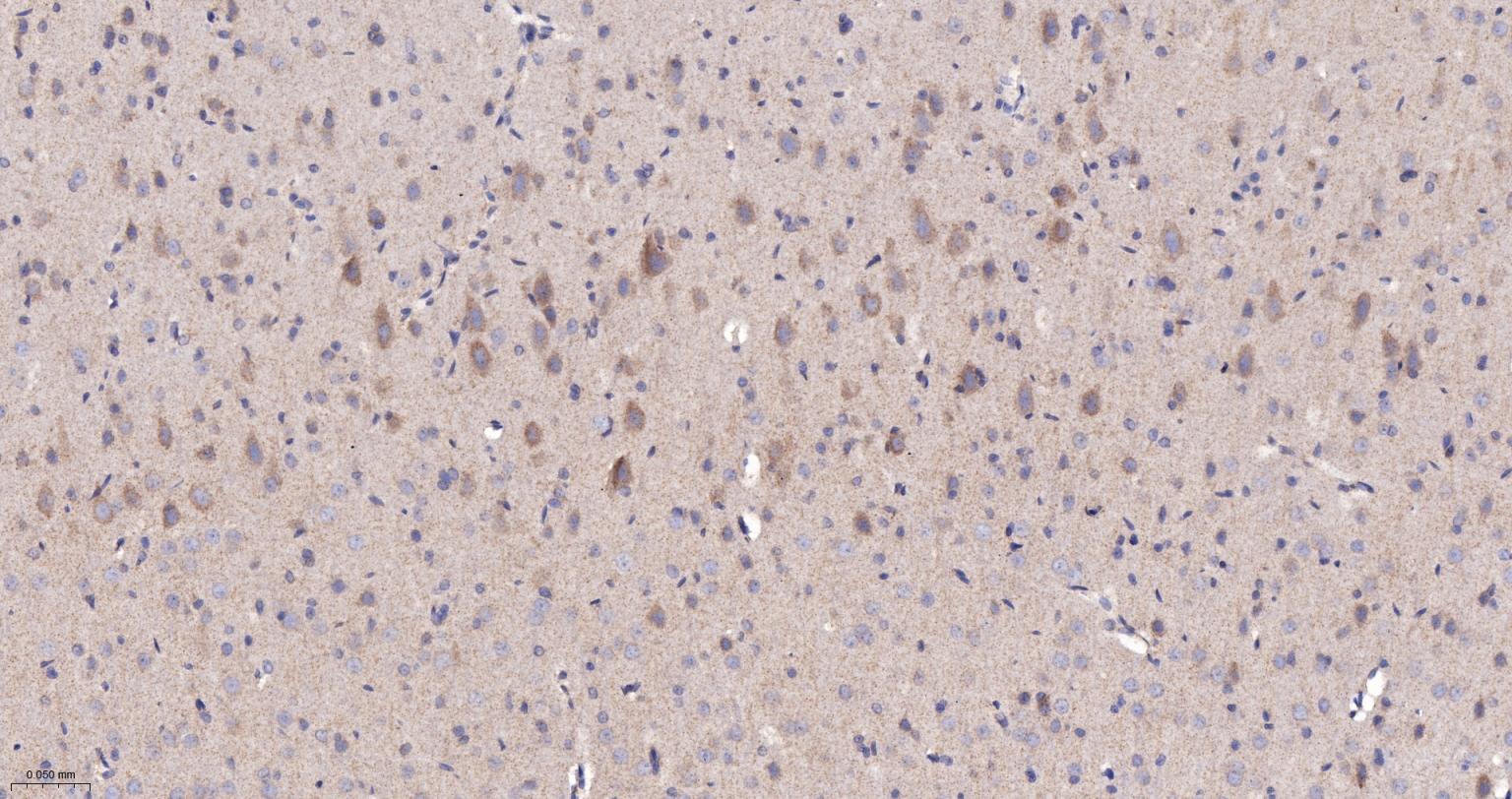 NDUFS2重组兔单抗-bsm-62748R