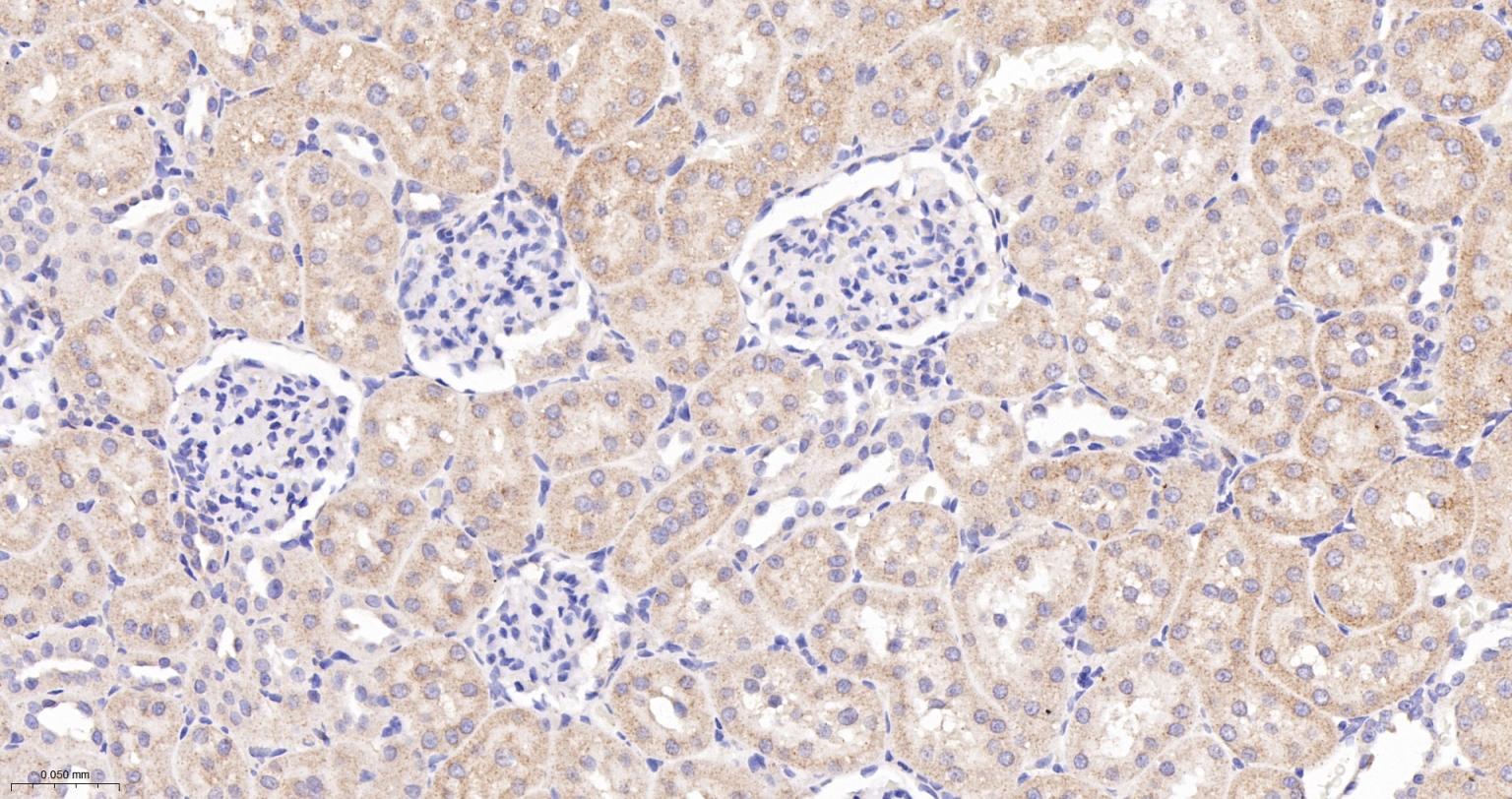 NDUFS2重组兔单抗-bsm-62748R