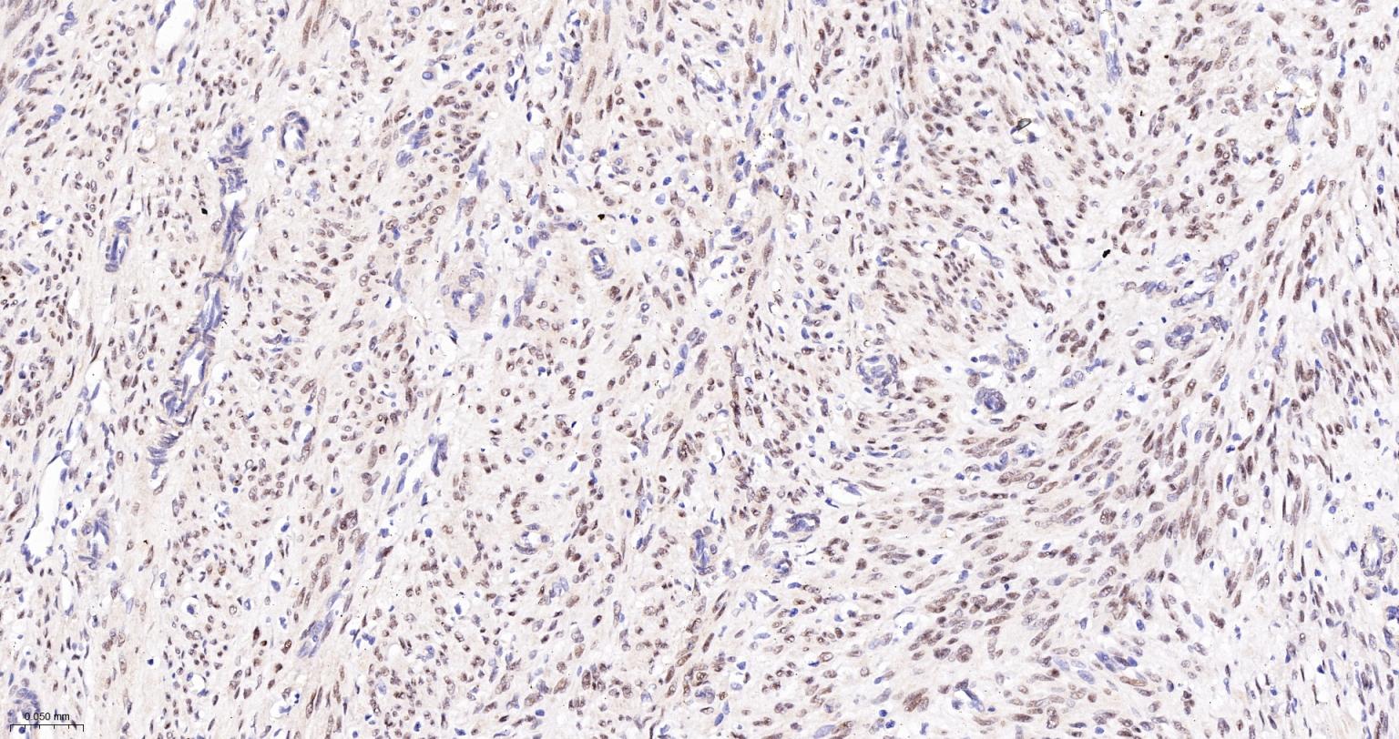 TEAD1重组兔单抗-bsm-63274R