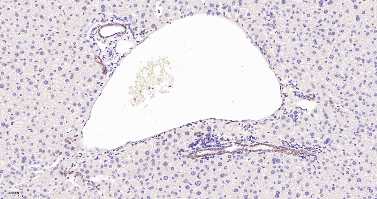TEAD1重组兔单抗-bsm-63274R