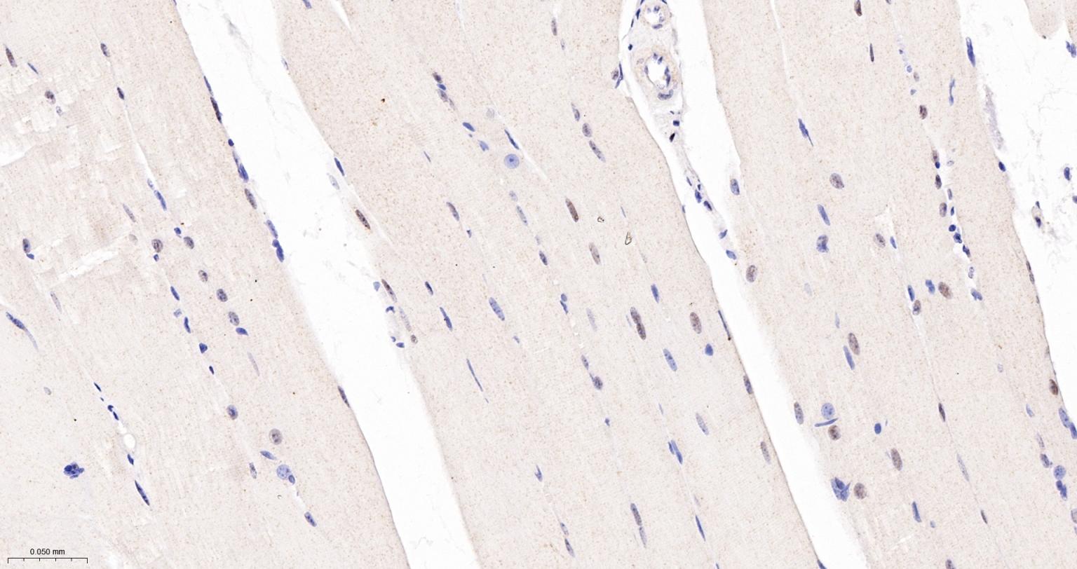 TEAD1重组兔单抗-bsm-63274R