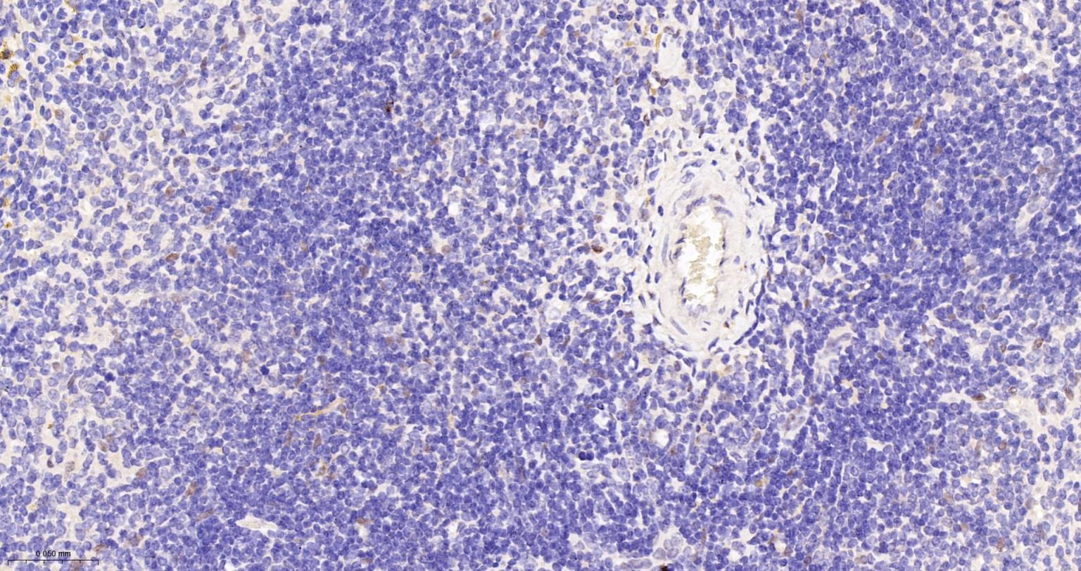 TEAD1重组兔单抗-bsm-63274R