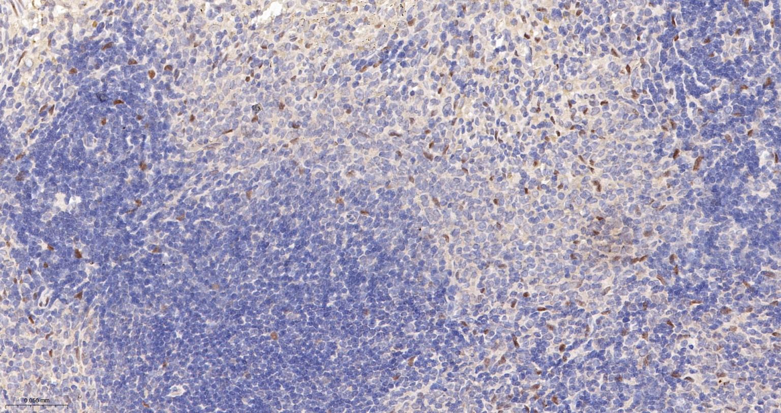 TEAD1重组兔单抗-bsm-63274R