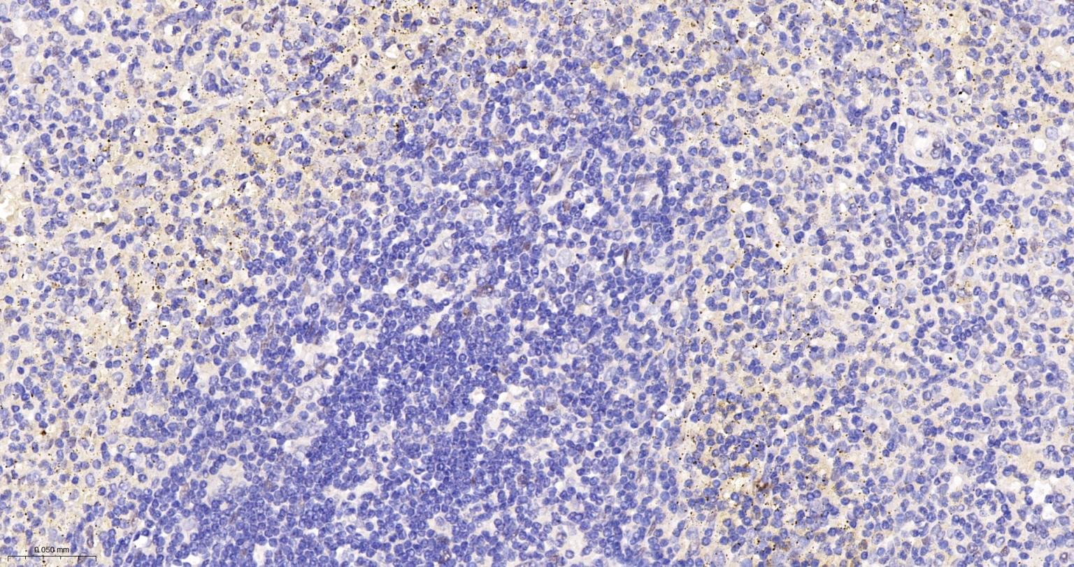 TEAD1重组兔单抗-bsm-63274R