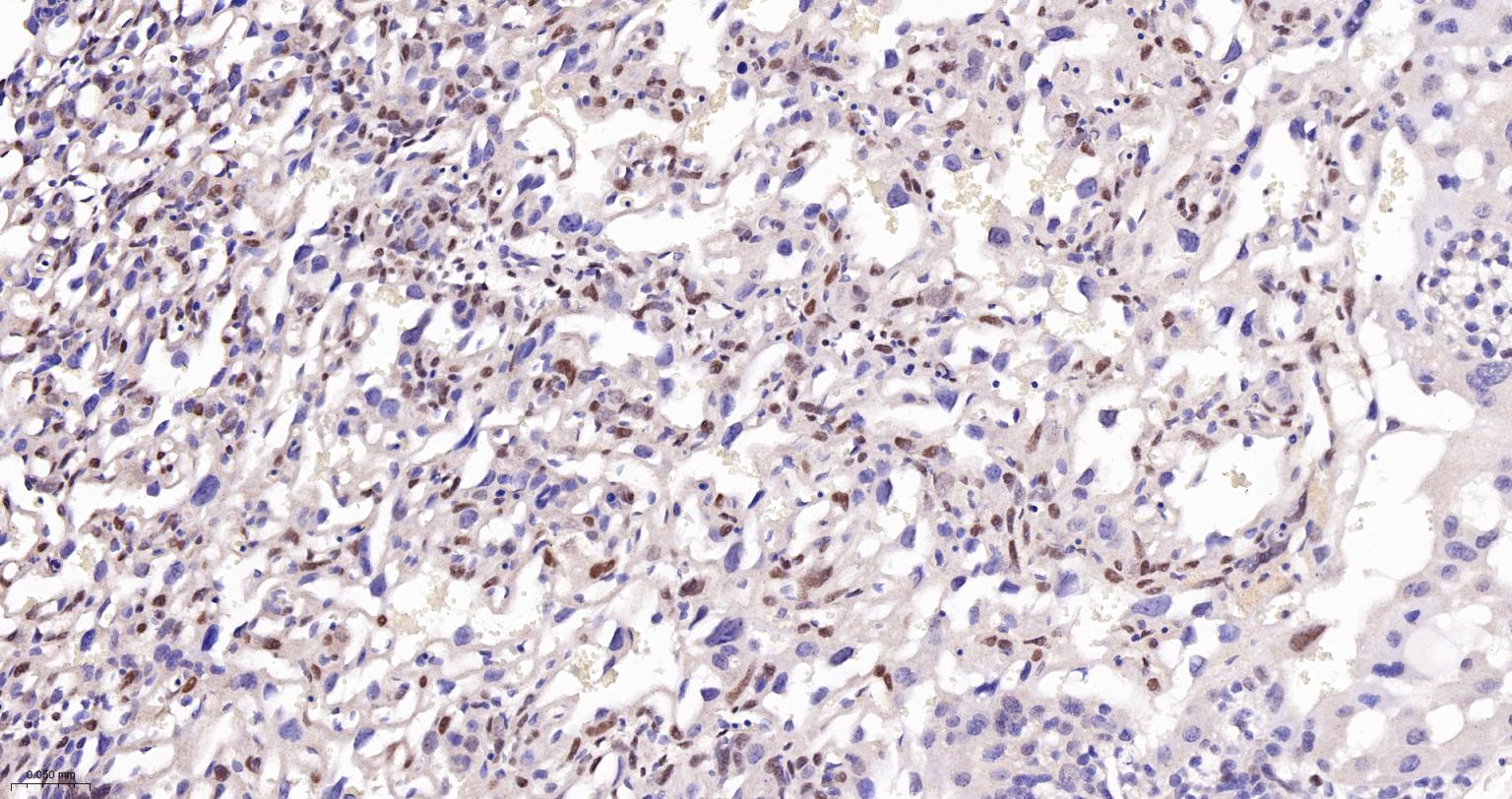 TEAD1重组兔单抗-bsm-63274R